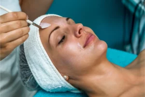 Chemical Peels Uptown Aesthetics & Wellness Martinsville VA