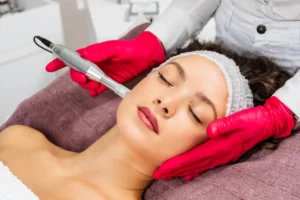 Microneedling with SkinPen in Martinsville, VA