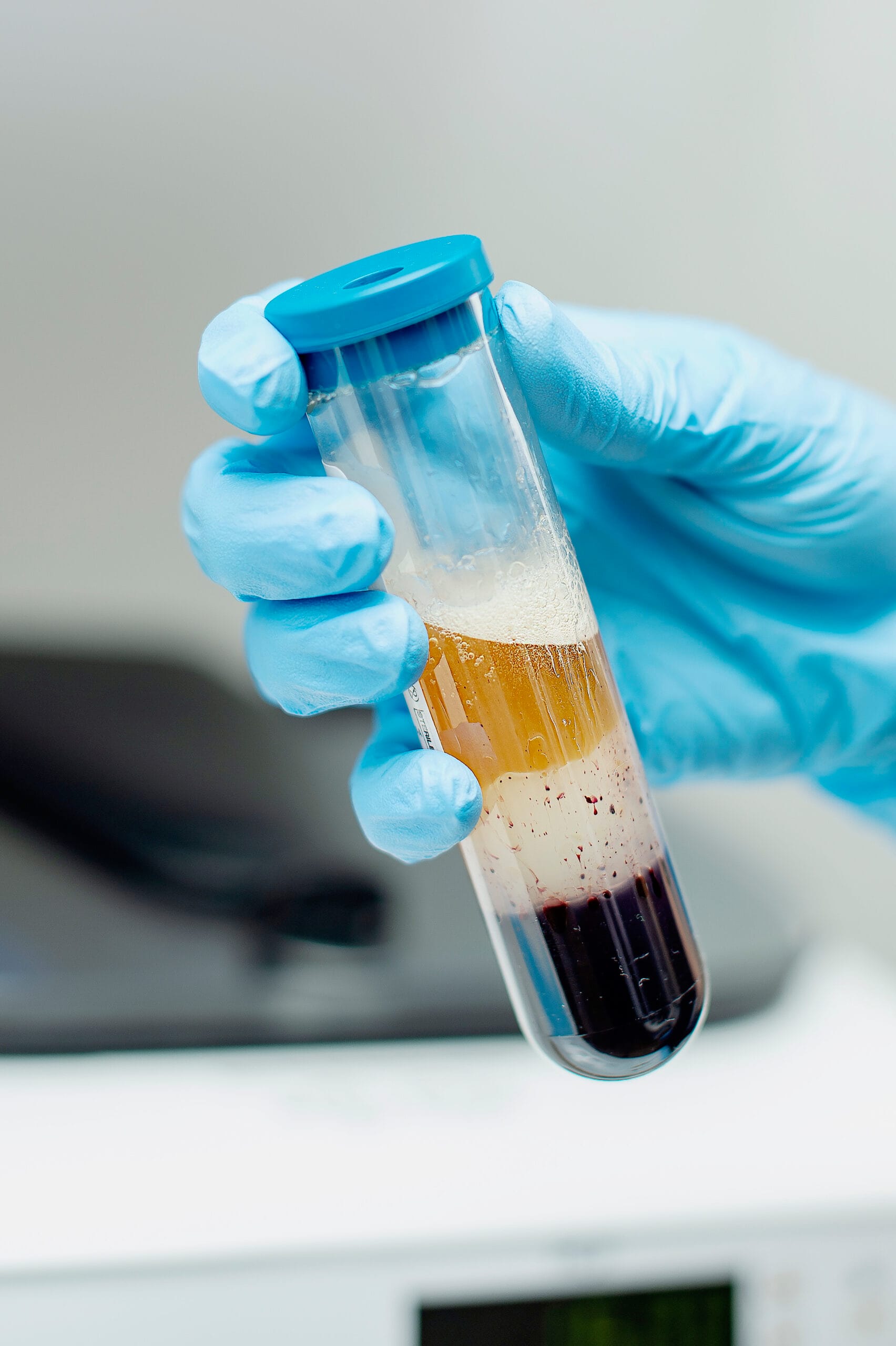 Tube showing platelets separated from plasma