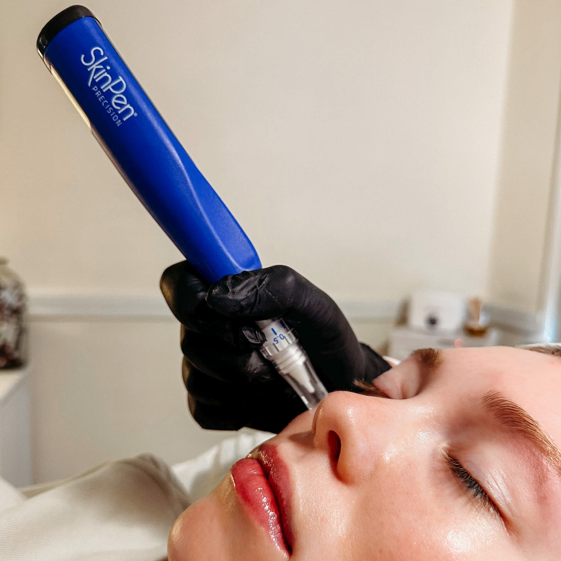 Client receiving microneedling treatment with SkinPen.