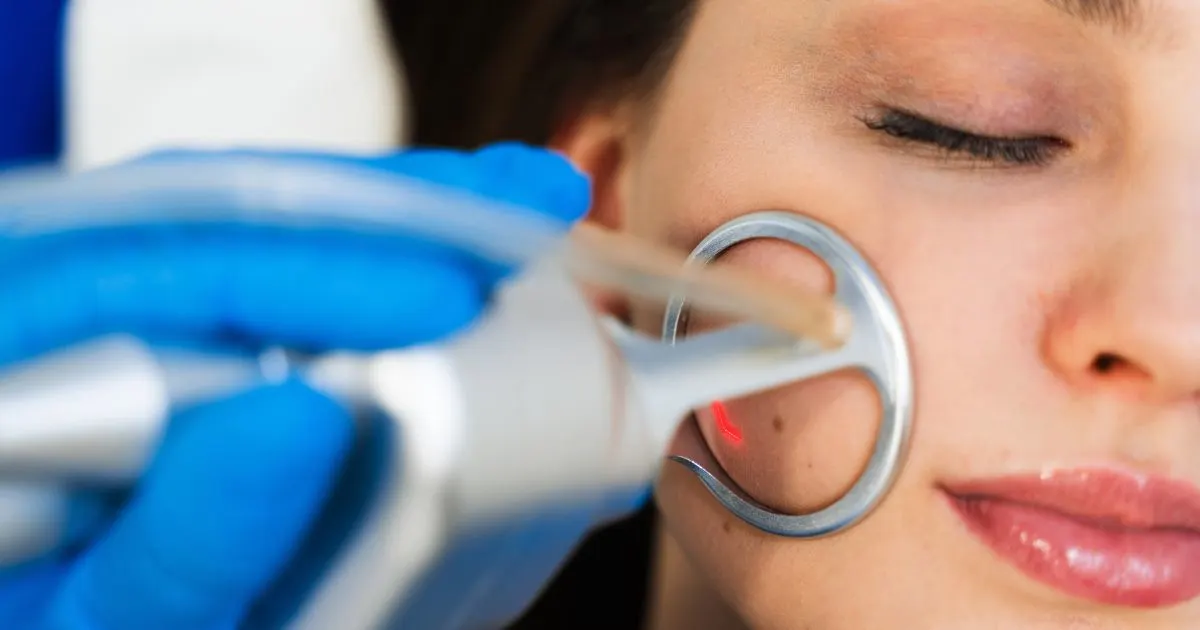 Smiling woman with clear, smooth skin after a successful Tetra laser skin tightening treatment.